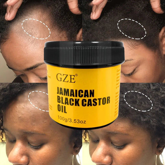 GZE JAMAICAN Black Castor Oil Pure Cold-Pressed for Hair Growth, Skin Moisturizing and Scalp Health - Promoting Thick Hair SHOWLU FASHION STORE