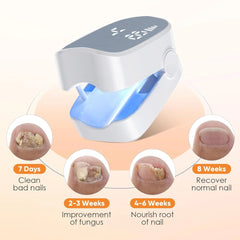1pcs Effective Rechargeable Nail Fungus Remover Nail Fungus Cleaning Laser Device Repair Damaged Discolored Thick Fingernails - SHOWLU FASHION STORE