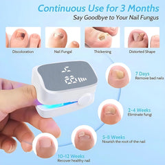 Nail Fungus Treatment Tools Fungal Nail Treatment Anti - Equipment Effectively Remove Fungal Toenail Nail Fungal Infection - SHOWLU FASHION STORE