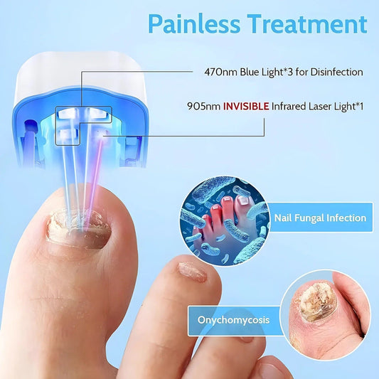 Nail Fungus Treatment Tools Fungal Nail Treatment Anti - Equipment Effectively Remove Fungal Toenail Nail Fungal Infection - SHOWLU FASHION STORE