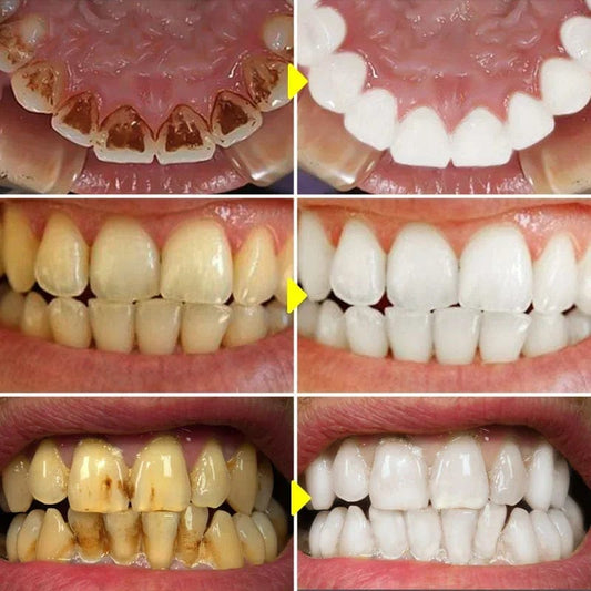SP - 6 Probiotic Toothpaste Whitening Tooth Remove Plaque Stains Teeth Whitener Oral Hygiene Clean Fresh Breath Denta 120g 2024 - SHOWLU FASHION STORE