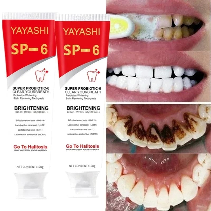 SP - 6 Probiotic Toothpaste Whitening Tooth Remove Plaque Stains Teeth Whitener Oral Hygiene Clean Fresh Breath Denta 120g 2024 - SHOWLU FASHION STORE